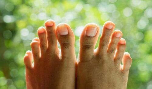 D'après la photographie, comment peut-on qualifier les pieds de cette personne ? 