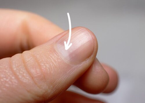 Quel est le nom de la tache blanche en demi-lune située à la base des ongles ? 