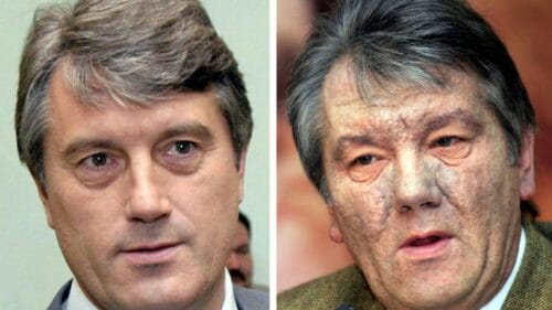 Quel est le nom de cet ancien président ukrainien ayant subi en 2004 une intoxication qui pourrait être un empoisonnement ? 
